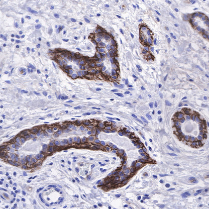 CD49b / Integrin alpha 2 Recombinant Rabbit mAb (SDT-399-52)
