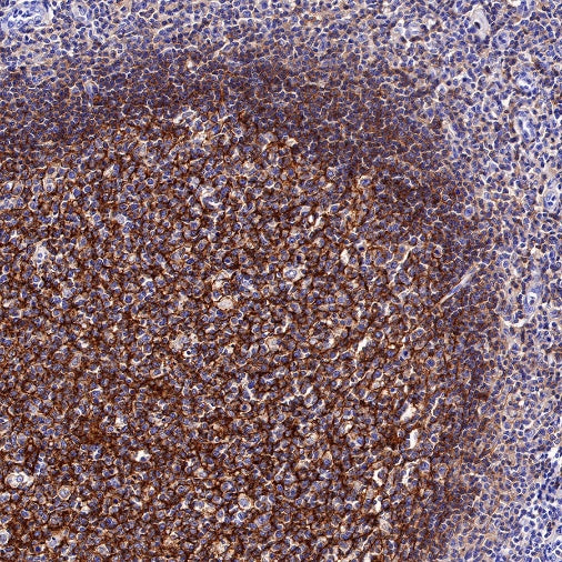 CD35 Recombinant Rabbit mAb (SDT-R224)