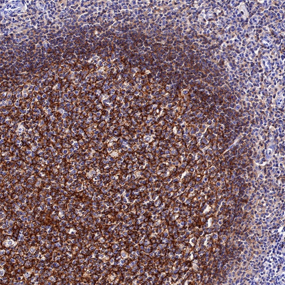 CD35 Recombinant Rabbit mAb (SDT-R224)