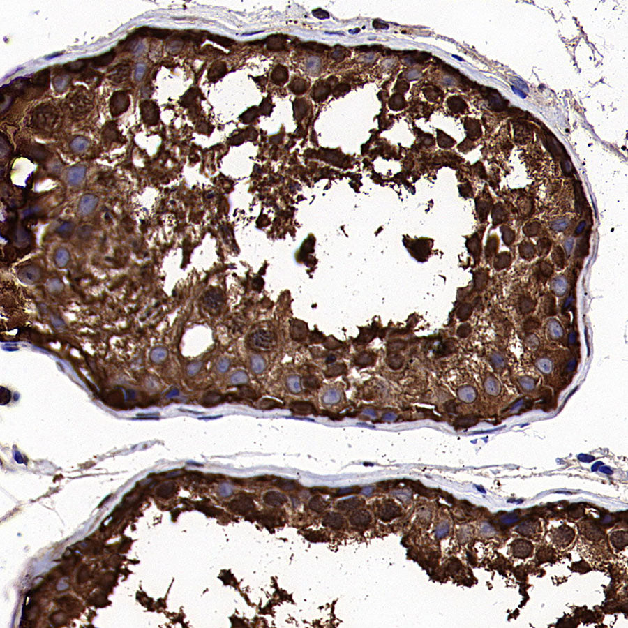 HSP90 Recombinant Rabbit mAb (S-5412)