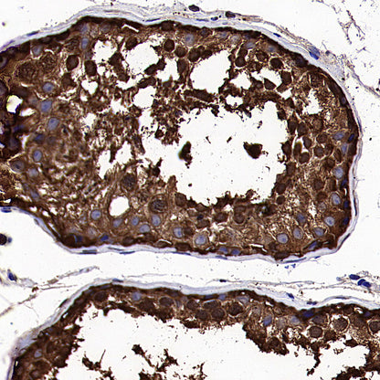 HSP90 Recombinant Rabbit mAb (S-5412)