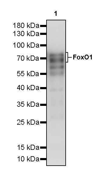 FoxO1 Recombinant Rabbit mAb (S-5118)