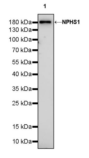 NPHS1 Recombinant Rabbit mAb (SDT-2148-63)