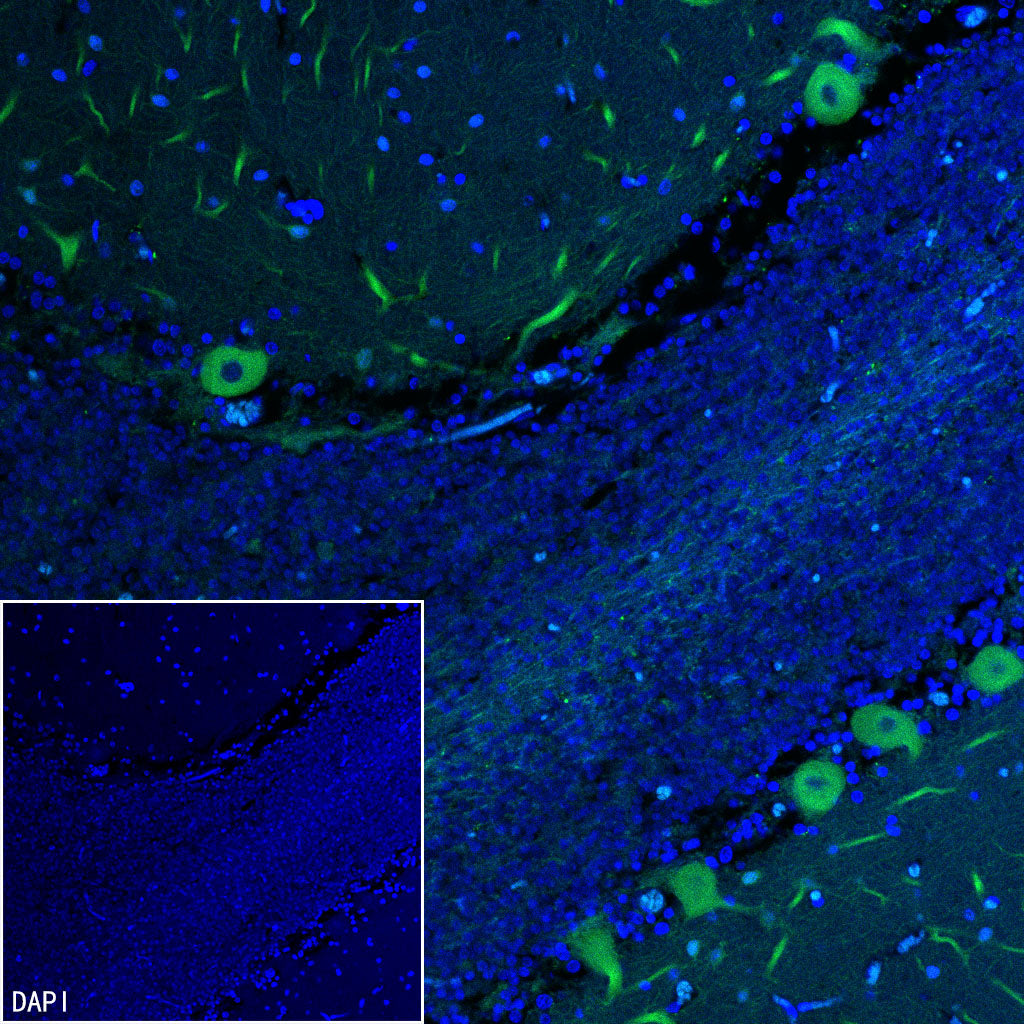 Beta III tubulin Recombinant Rabbit mAb (Alexa Fluor® 488 Conjugate) (SDT-251-28)