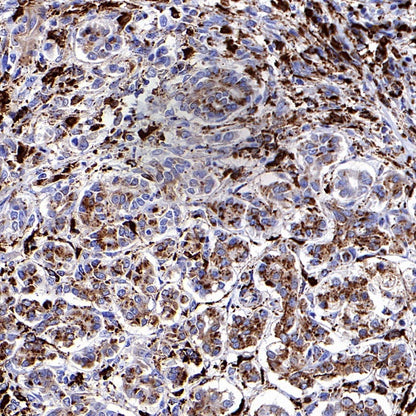 Cathepsin D Recombinant Rabbit mAb (S-R208)