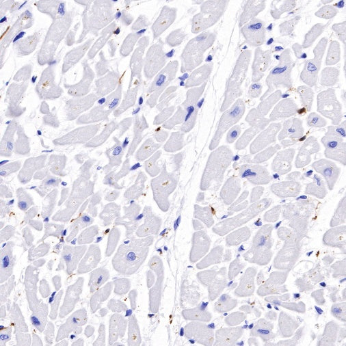 S-RMab® S100B Recombinant Rabbit mAb (SDT-518-45)