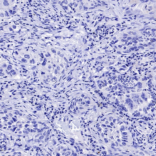 CACNA1S Recombinant Rabbit mAb (S-2448-78)