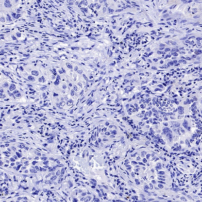 CACNA1S Recombinant Rabbit mAb (S-2448-78)