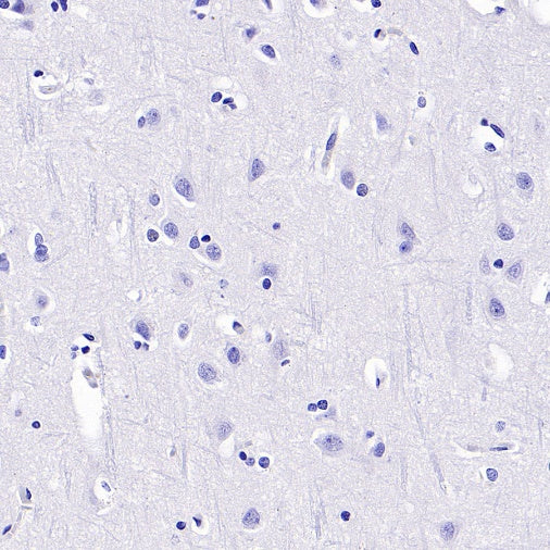 PAX8 Recombinant Rabbit mAb (SDT-R509)