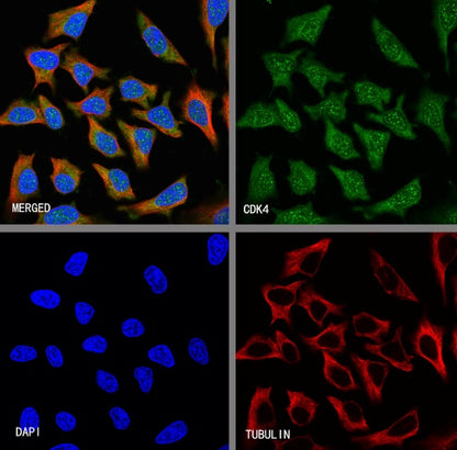 CDK4 Recombinant Rabbit mAb (S-685-210)