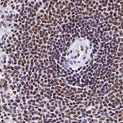 CDK11/CDC2L2/CDK11A Recombinant Rabbit mAb (S-3994-75)
