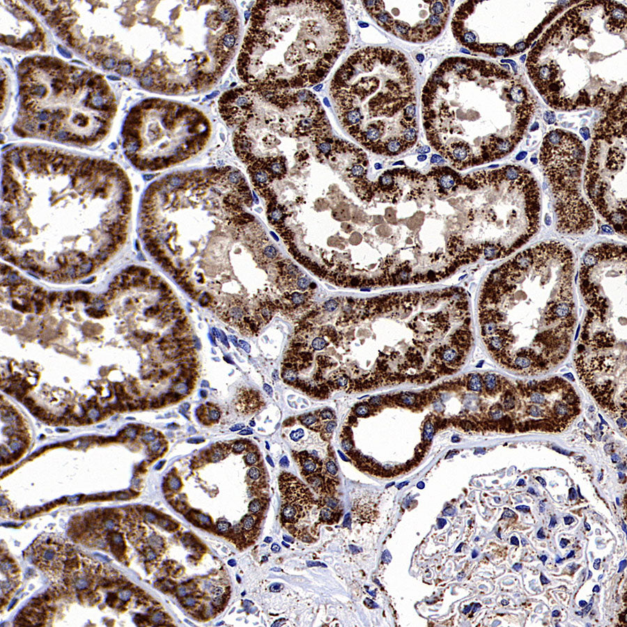 ALDH2 Recombinant Rabbit mAb (S-4173-20)