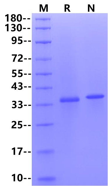 IGFBP-2 His Tag Protein, Human