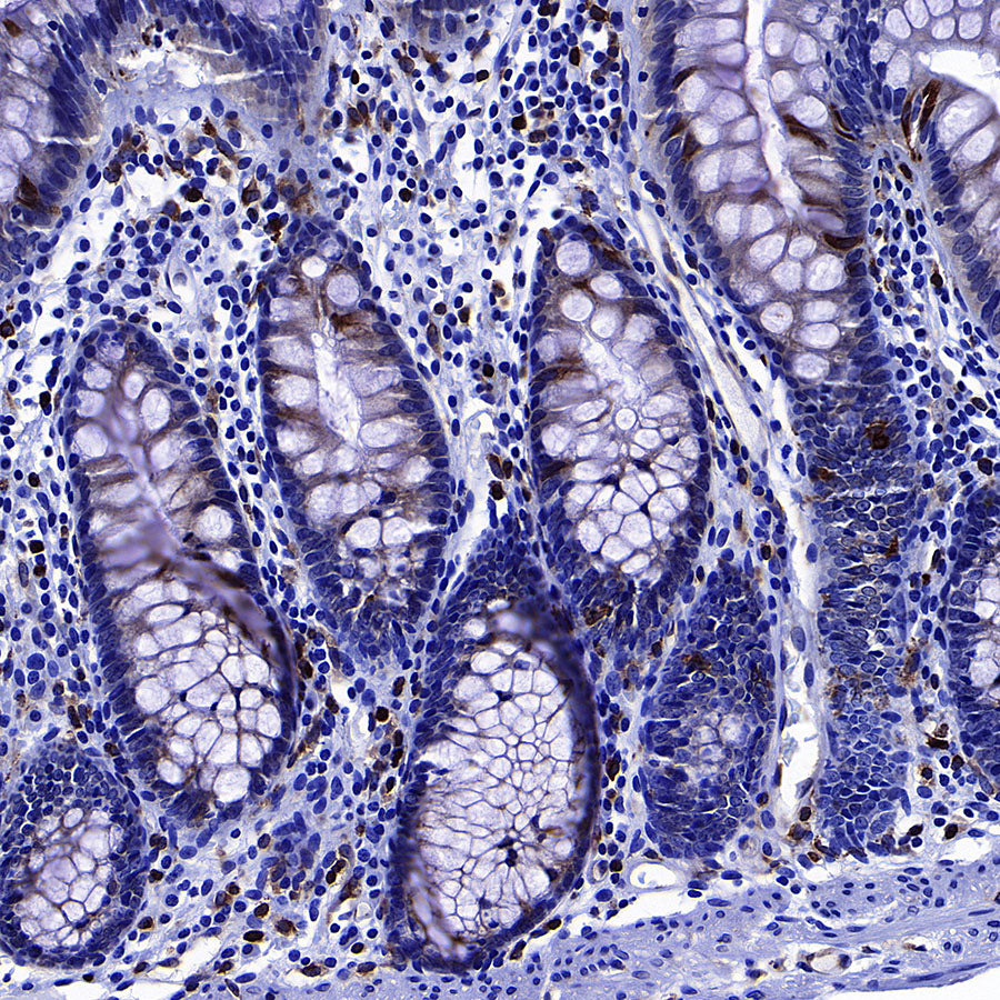 LPCAT2 Recombinant Rabbit mAb (S-4239-18)