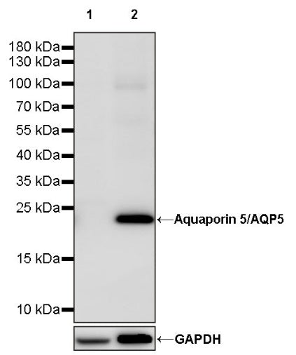 Aquaporin 5/AQP5 Recombinant Rabbit mAb (S-1622-5)