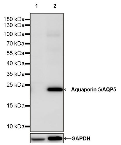 Aquaporin 5/AQP5 Recombinant Rabbit mAb (S-1622-5)