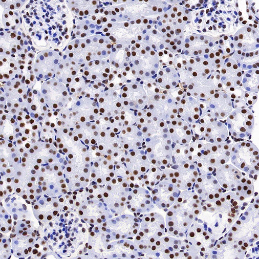 TAF15 Recombinant Rabbit mAb (S-1508-53)