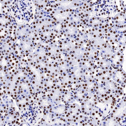 TAF15 Recombinant Rabbit mAb (S-1508-53)