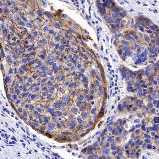 S-RMab® E-Cadherin Recombinant Rabbit mAb (SDT-438-5)