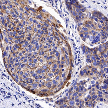 S-RMab® E-Cadherin Recombinant Rabbit mAb (SDT-438-5)