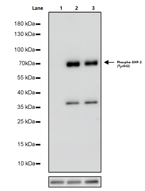 PDGF-BB Protein, Human
