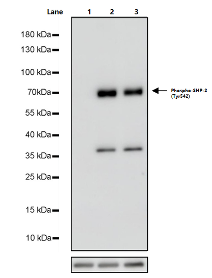PDGF-BB Protein, Human