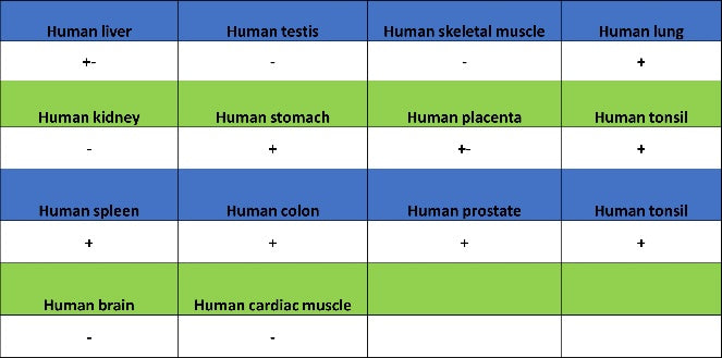 ALOX5 Recombinant Rabbit mAb (S-1980-27)