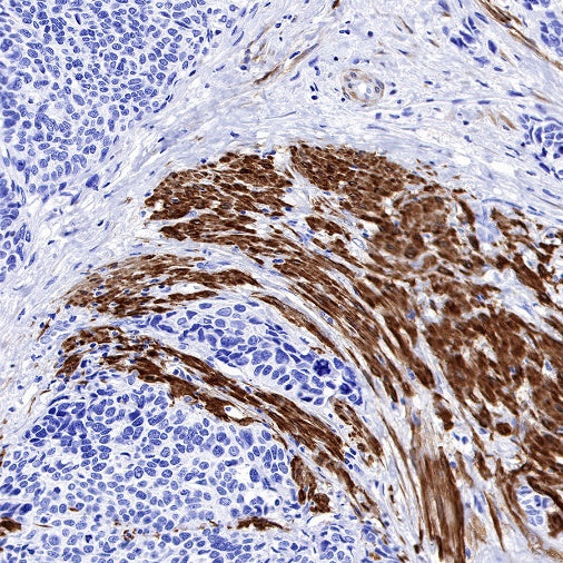Calponin-1 Recombinant Rabbit mAb (S-R161)