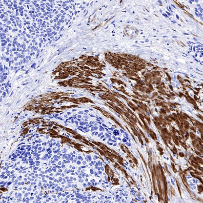 Calponin-1 Recombinant Rabbit mAb (S-R161)