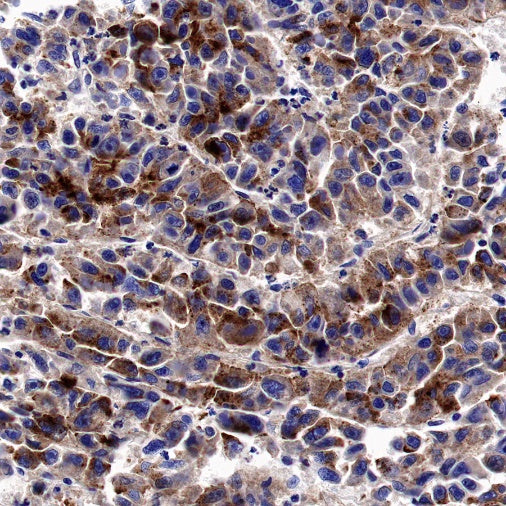 Osteopontin Recombinant Rabbit mAb (S-1005-50)
