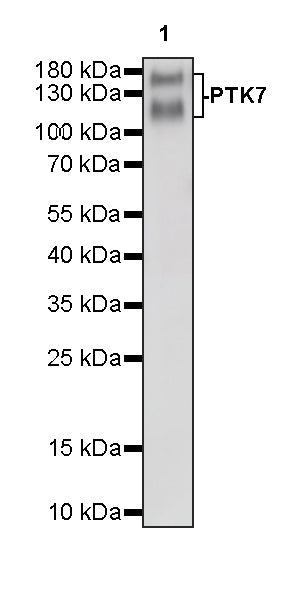 PTK7 Recombinant Rabbit mAb (SDT-2432-136)