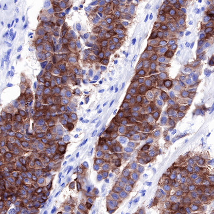 Tau Recombinant Rabbit mAb (SDT-171-67)