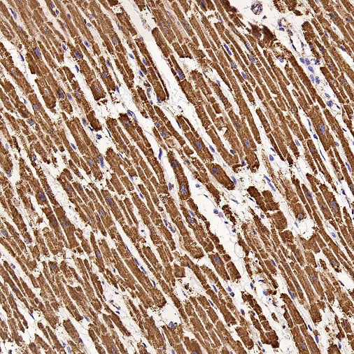 UQCRC2 Recombinant Rabbit mAb (S-2374-127)