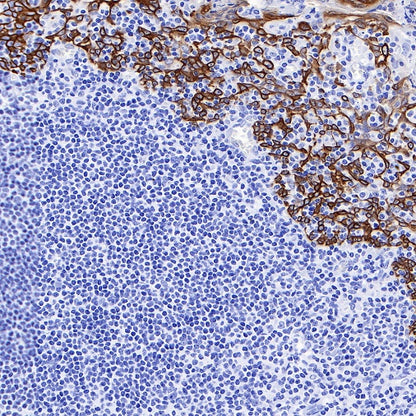 Keratin 16 Recombinant Rabbit mAb (S-R306)