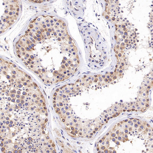 G3BP1 Rabbit Polyclonal Antibody