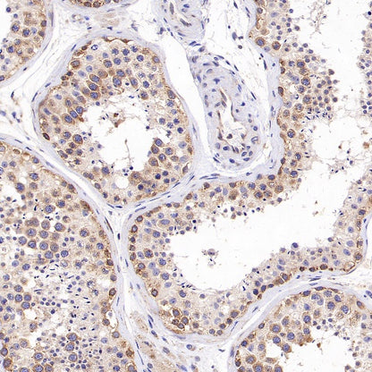 G3BP1 Rabbit Polyclonal Antibody