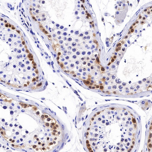 Caspase-7 Recombinant Rabbit mAb (S-R254)