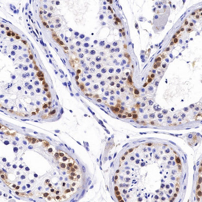 Caspase-7 Recombinant Rabbit mAb (S-R254)
