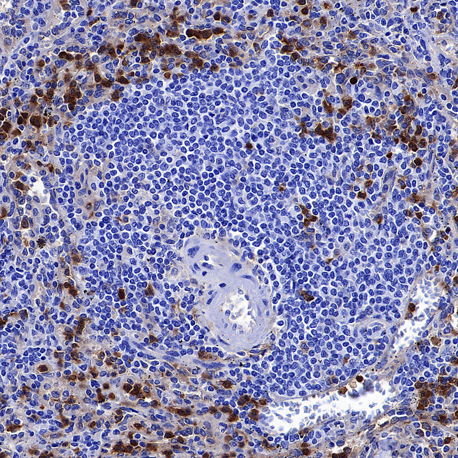 uPAR/CD87 Recombinant Rabbit mAb (S-3960-82)