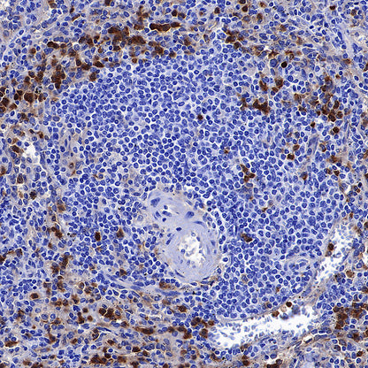 uPAR/CD87 Recombinant Rabbit mAb (S-3960-82)