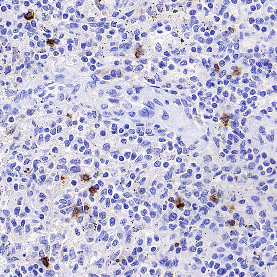 TRDC/TCR delta Recombinant Rabbit mAb (S-5148)