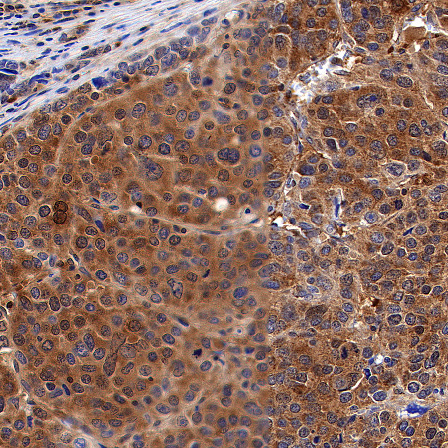 ALDH9A1 Recombinant Rabbit mAb (S-4115-48)