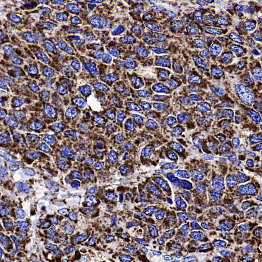 VDAC1 Recombinant Rabbit mAb (S-5314)