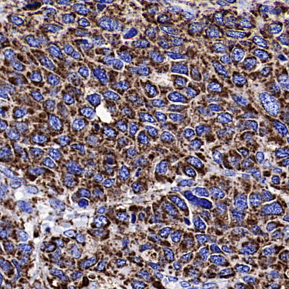 VDAC1 Recombinant Rabbit mAb (S-5314)