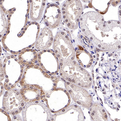 RIPK1 Rabbit Polyclonal Antibody