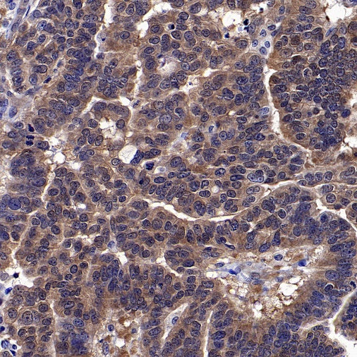 Park7/DJ-1 Recombinant Rabbit mAb (S-980-144)