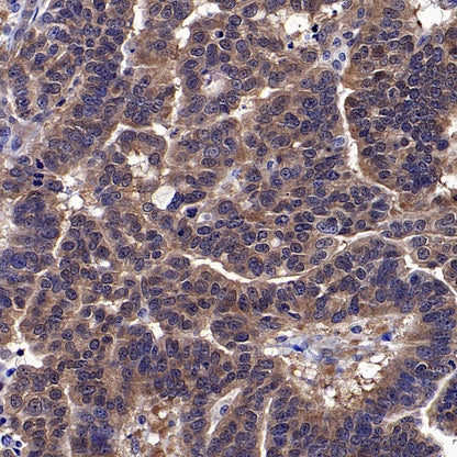 Park7/DJ-1 Recombinant Rabbit mAb (S-980-144)