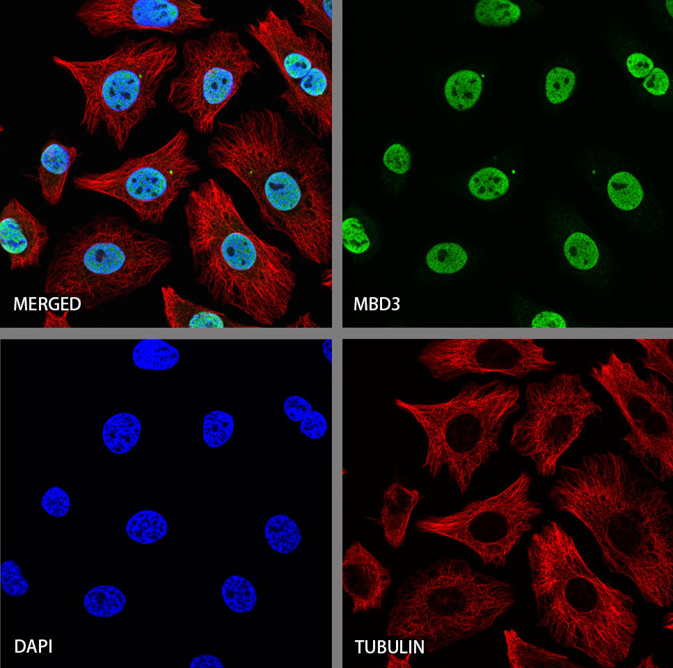 MBD3 Recombinant Rabbit mAb (S-4367)
