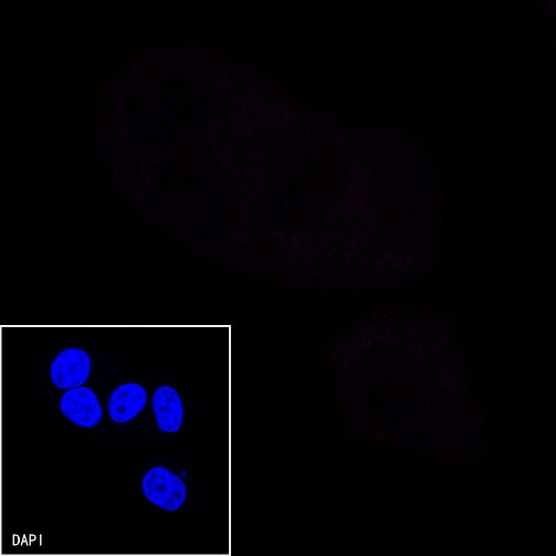p16 Recombinant Rabbit mAb (Cy5 Conjugate) (S-303-1)