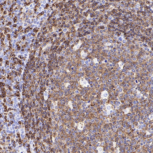CD45RA Recombinant Mouse mAb (HI100)